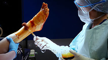 practice-foot-surgery