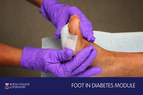 Foot in Diabetes Course 600 x 400